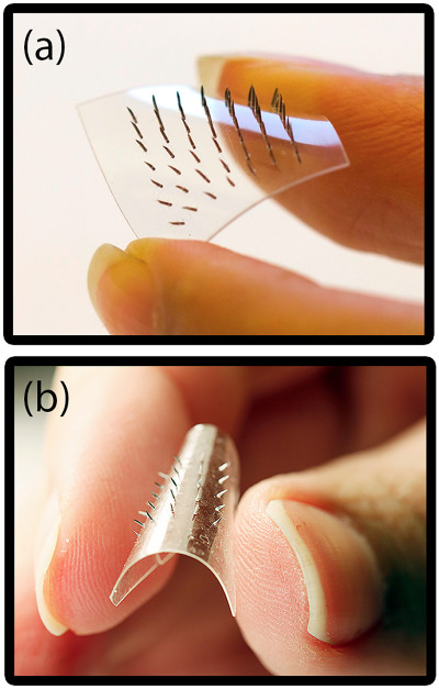 41 FlexibleStretchableMicroneedlePatches 400